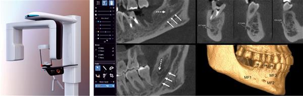 CBCT_pic_graphic_A