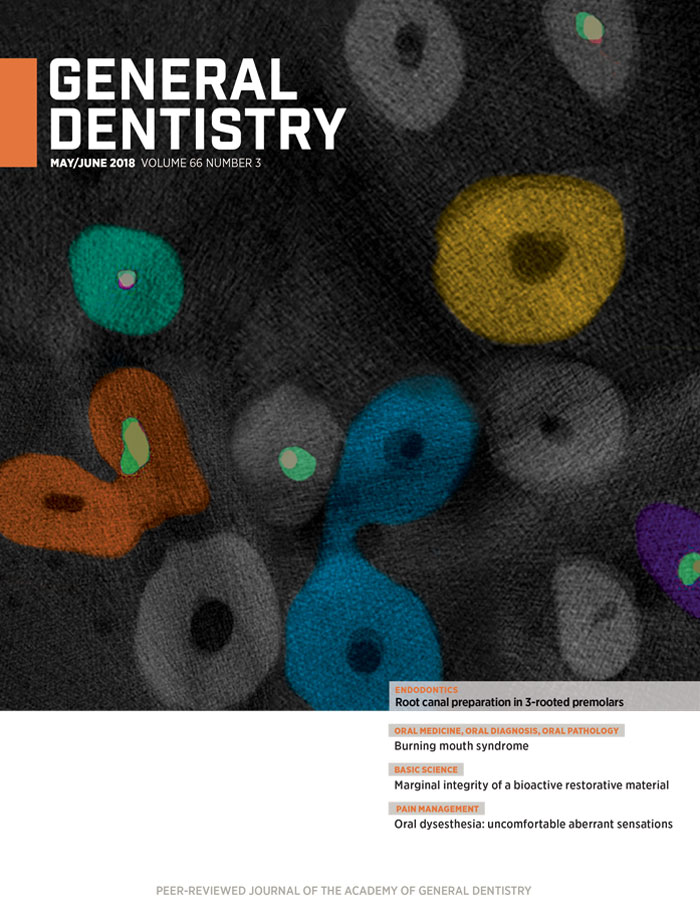 General Dentistry May/June 2018 Cover 