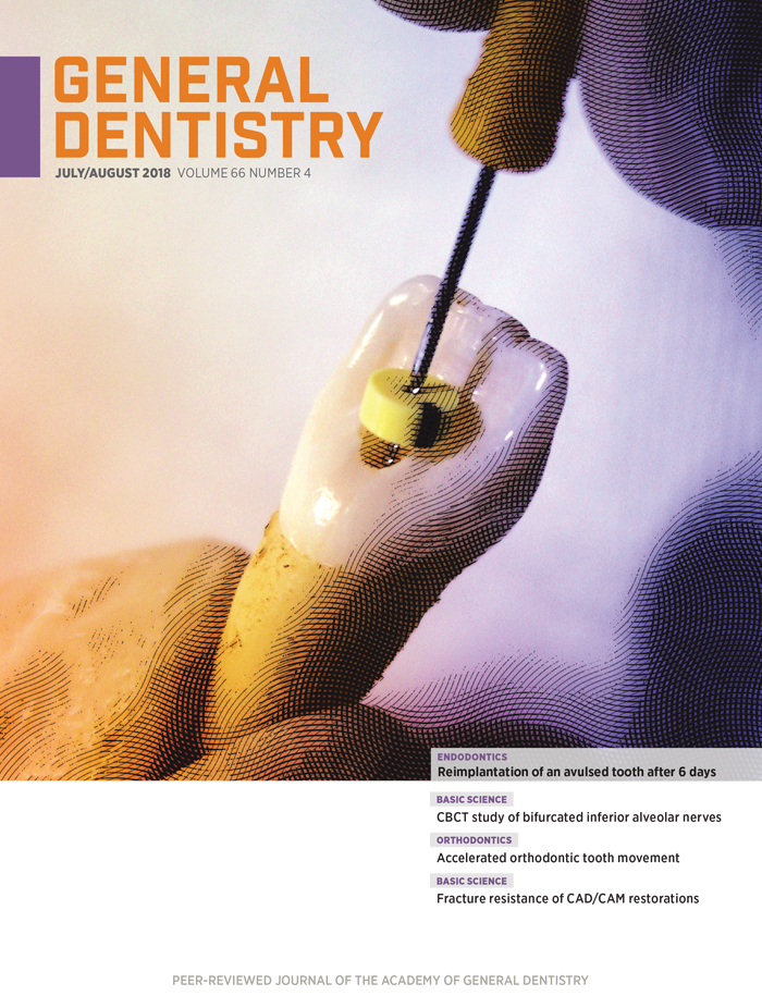 July/August 2018 General Dentistry Cover 