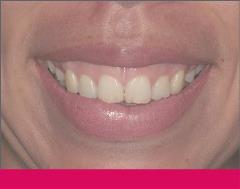 3-29-21_GenDen_B 3-29-21_GenDen_B